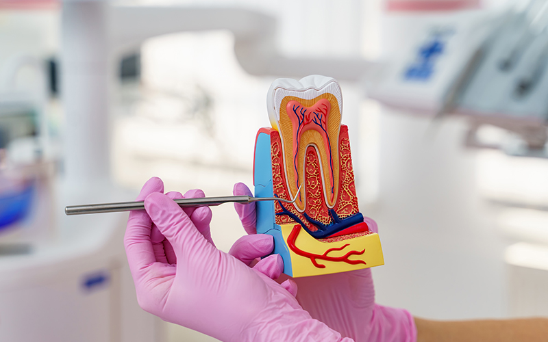 Root canal treatment in Erin